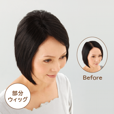 医療用ウィッグ